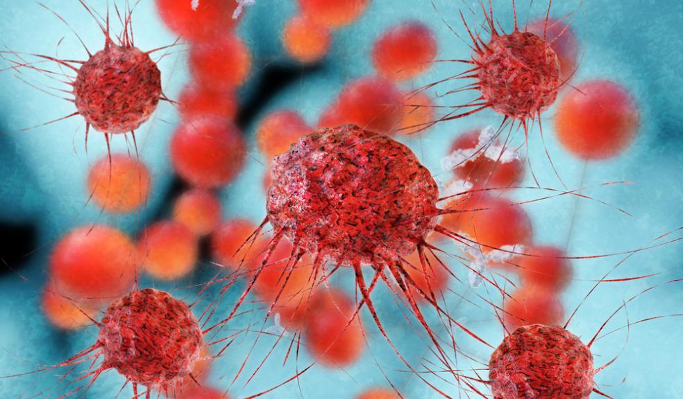 new-test-accurately-detects-ovarian-cancer-the-devon-daily